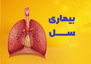 شیوع سل در سیستان‌وبلوچستان بالاتر از میانگین کشوری