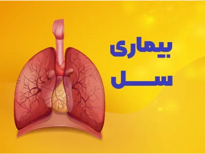 شیوع سل در سیستان‌وبلوچستان بالاتر از میانگین کشوری