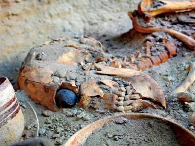 چشم مصنوعی در بهترین حالت نگهداری ماند